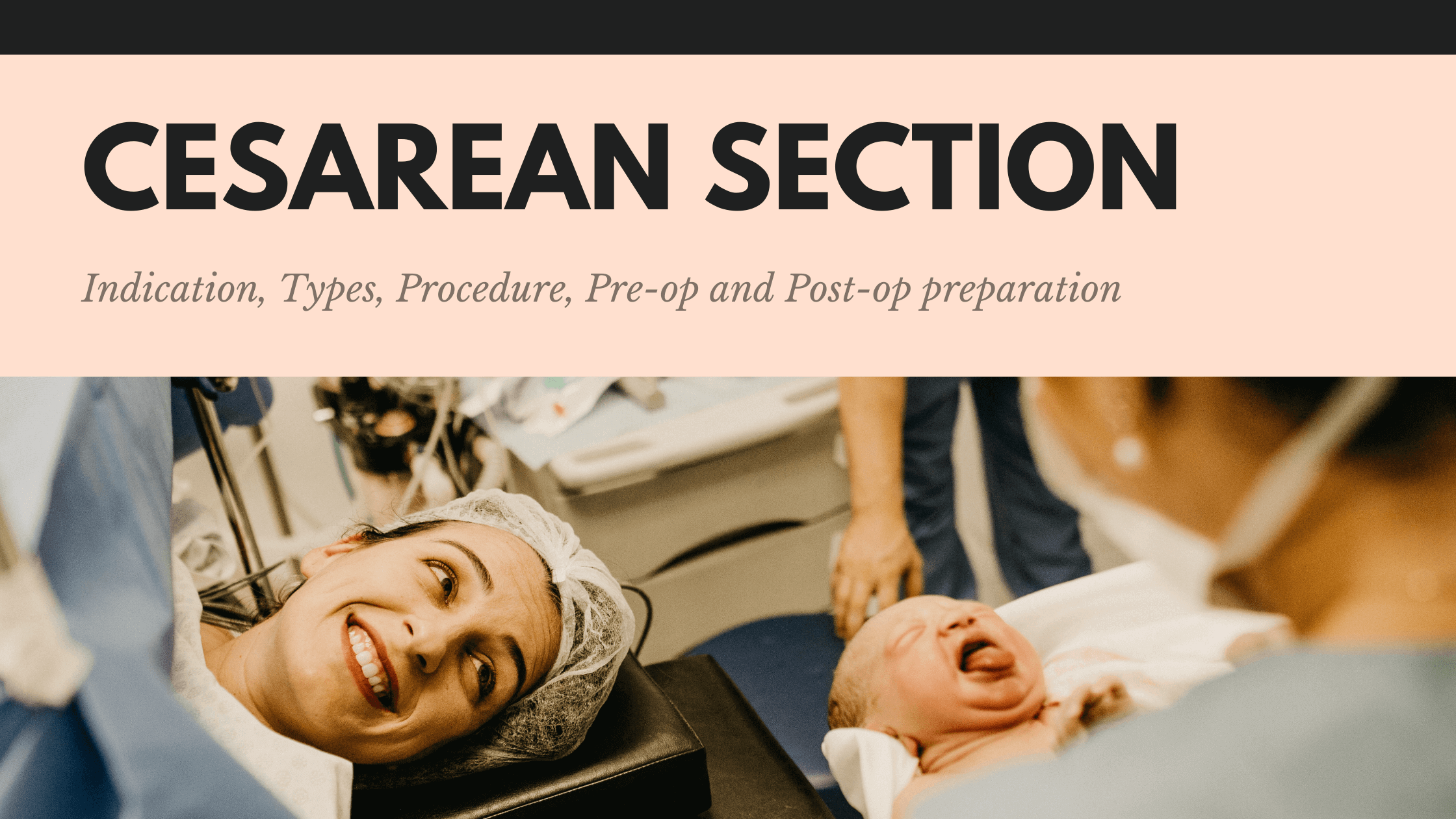 Every thing you need to know about cesarean sectionO