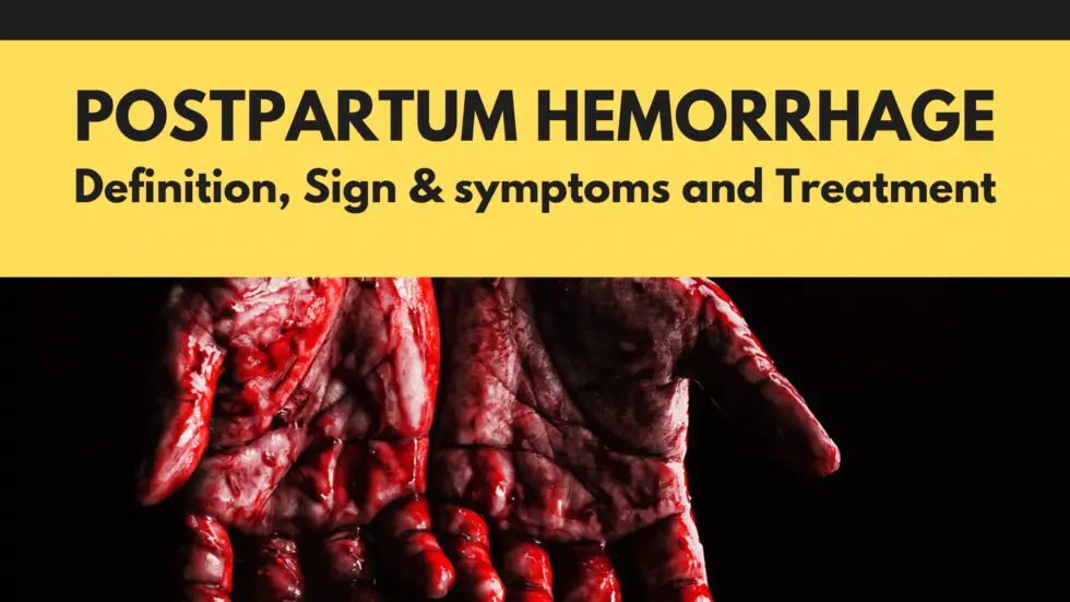 postpartum-hemorrhage-pph-definition-risks-management-life-as-md