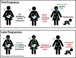 This is how Rh incompatiblity affect a pregnancy.