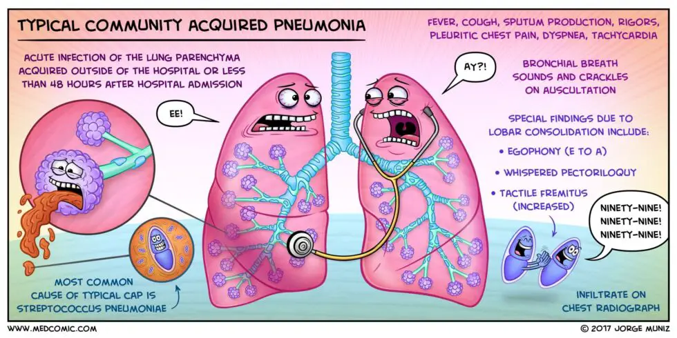 pneumonia lung sounds